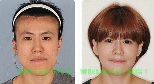 揭秘整型，核心知识点全面解析 第3张