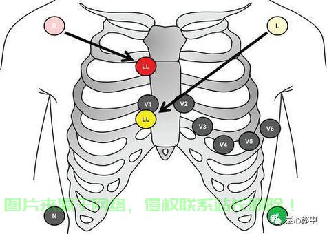 左连接深度解析及实战应用指南 第1张