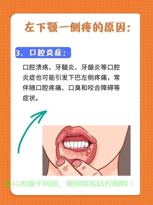 左连接深度解析及实战应用指南 第2张