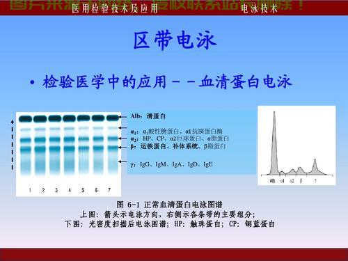 VPS电泳分析软件全解析,功能、优势及应用领域深度探讨 第2张 VPS电泳分析软件全解析,功能、优势及应用领域深度探讨 第2张