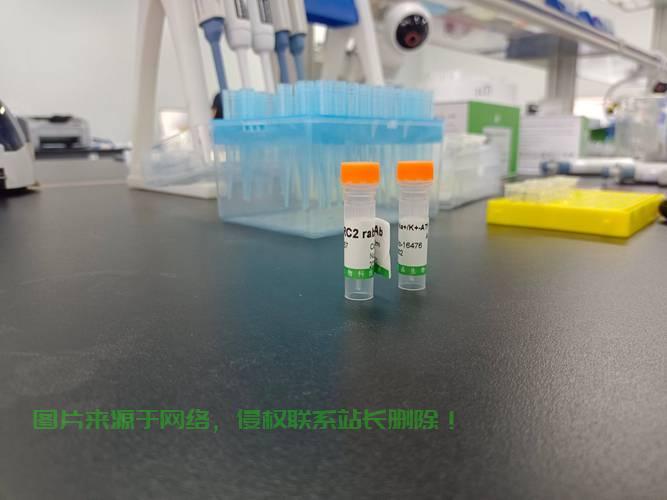 重磅揭秘，VPS13B抗体的功能与重要性解析 第1张