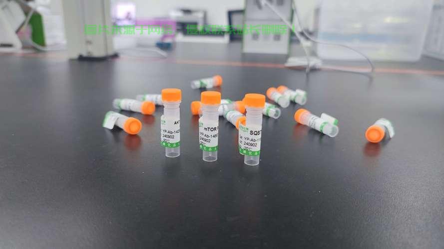 重磅揭秘，VPS13B抗体的功能与重要性解析 第3张