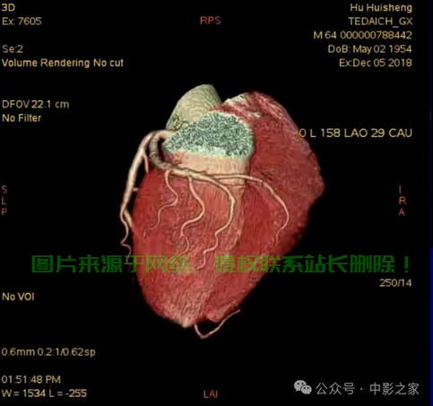 心脏VPS部位深度解析，揭秘心脏核心结构奥秘！ 第2张