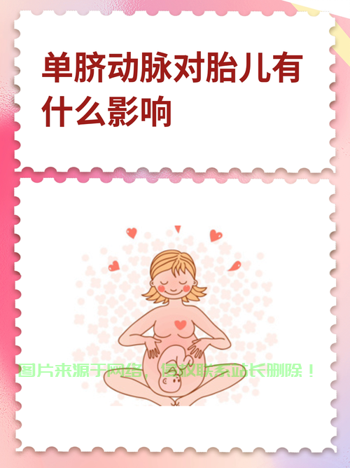 脐动脉vps67.7，深度解读与重点关注 第1张