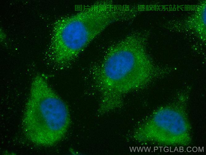 揭秘生物界神秘角色,VPS深度解析 第2张 揭秘生物界神秘角色,VPS深度解析 第2张